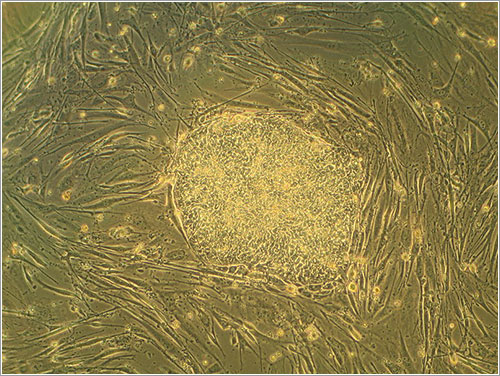 Colonia de células madre embrionarias humanas