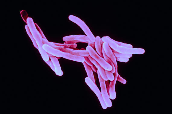 Mycobacterium tuberculosis - Sanofi Pasteur