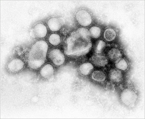 Virus N1H1 - CDC