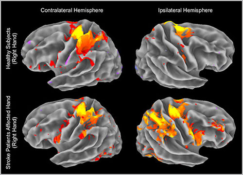 Fmri fMRI del movimiento de una mano