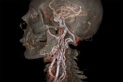 Interior-Cuerpo-Humano-Ct-Ge-1