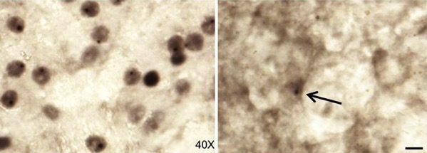 Acumulaciones de proteínas entes y después