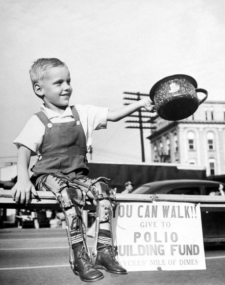 Niño incapacitado por la polio